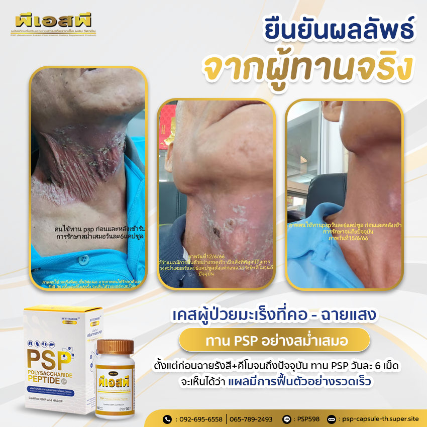 PSP WEB BN ผลลัพธ์จากผู้ทาน พีเอสพี 1