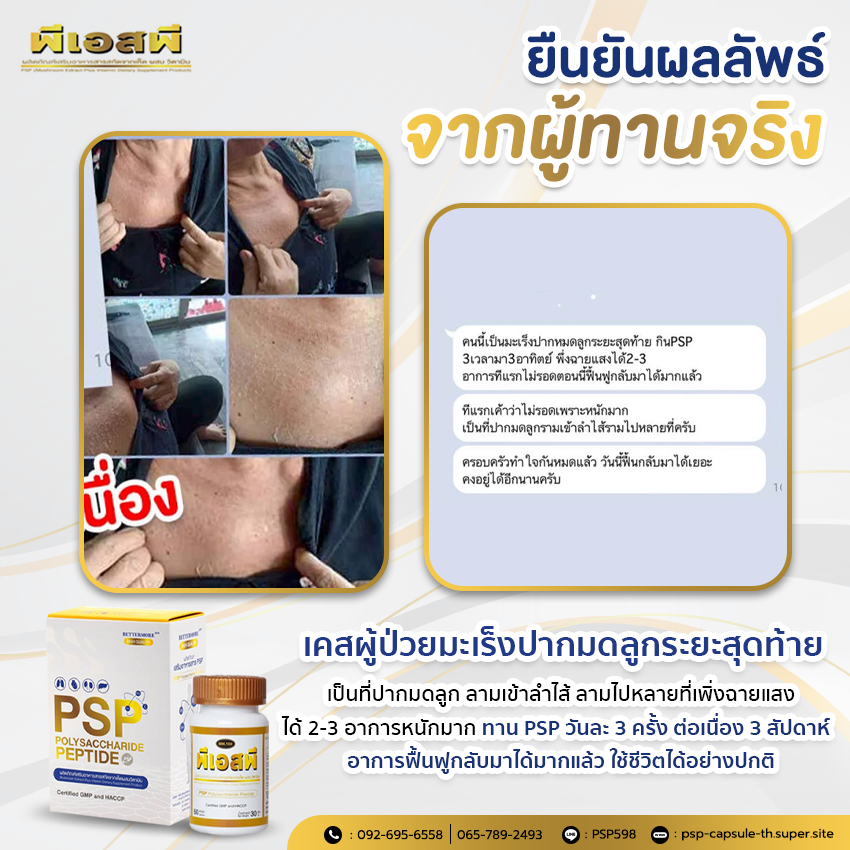 PSP WEB BN ผลลัพธ์จากผู้ทาน พีเอสพี 3