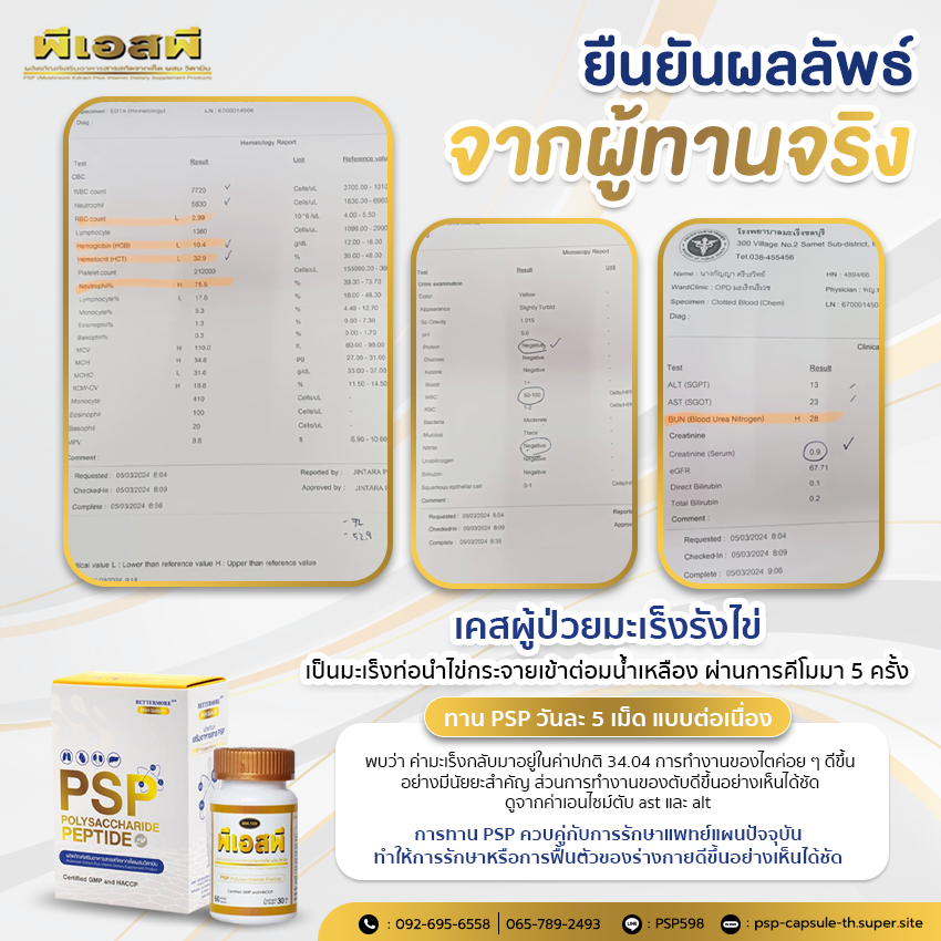 PSP WEB BN ผลลัพธ์จากผู้ทาน พีเอสพี 4
