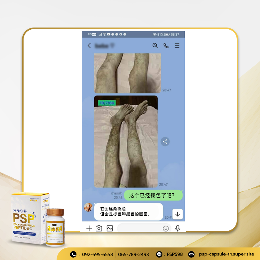 PSP Chinese WEB BN ภาพประกอบแปลจีน (1-8) 4